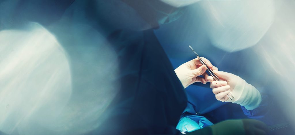 Laparoscopic Cholecystectomy