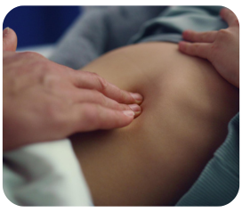 small umbilical hernia